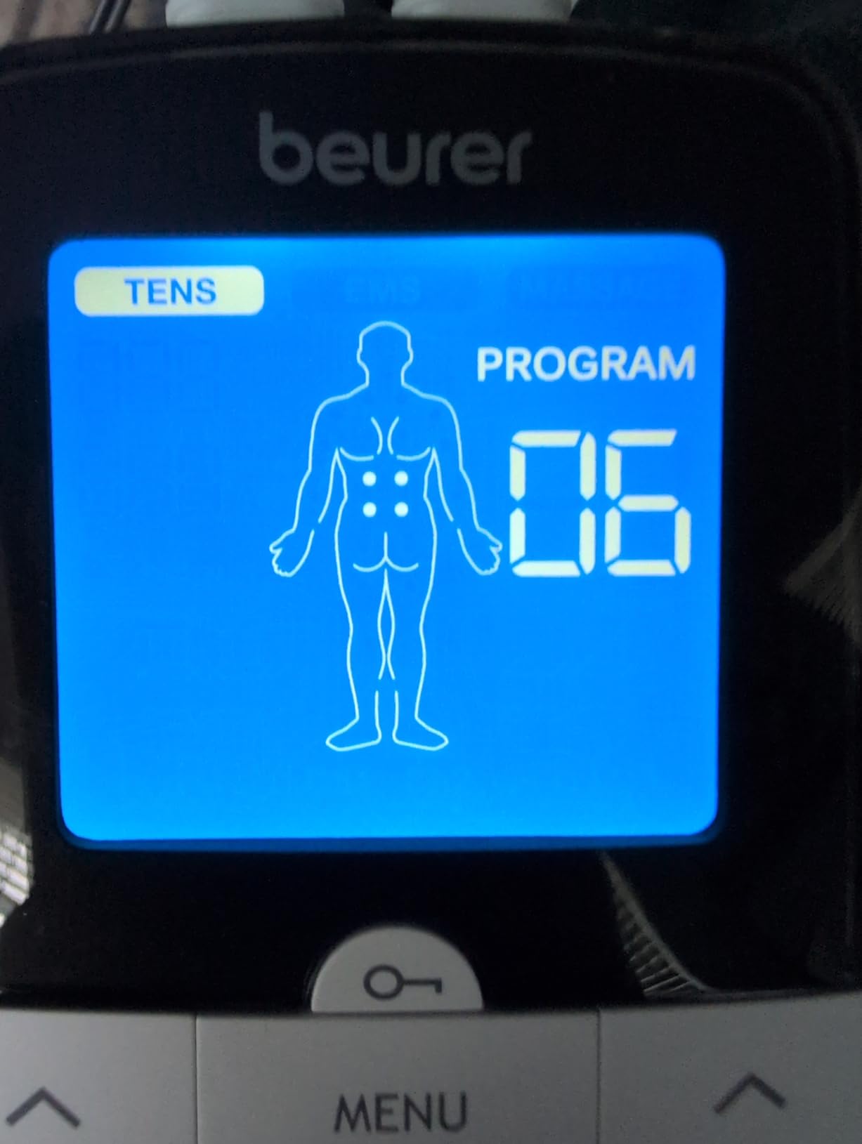 Beurer EM59 Digital 3-in-1 TENS Unit, EMS & Heat Therapy for Pain Relief & Relaxation, Muscle Stimulator with 2 Adjustable Channels, 64 Applications, Timer Function customer photo 2