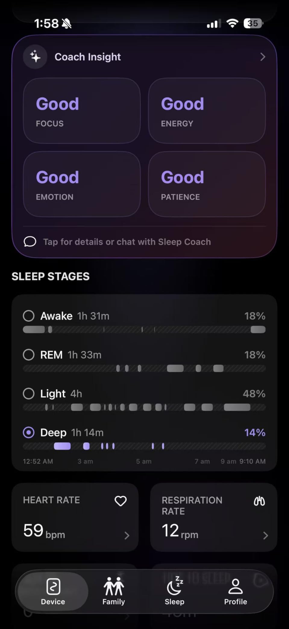OZI Smart Sleep Tracker, Non-Wearable Contactless Under-Sheet Sleep Monitor - No Monthly Fees, Tracks Sleep Stages, Heart Rate, Breathing, Movement, and Bed-Exit in Real-Time customer photo 1