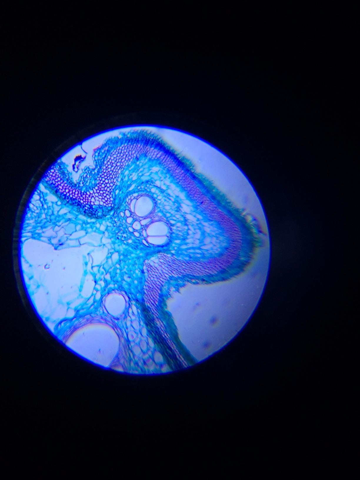 AmScope M30-ABS-KT1-WM 240X-480X-1200X Metal Arm Compound Microscope Kit customer photo 1