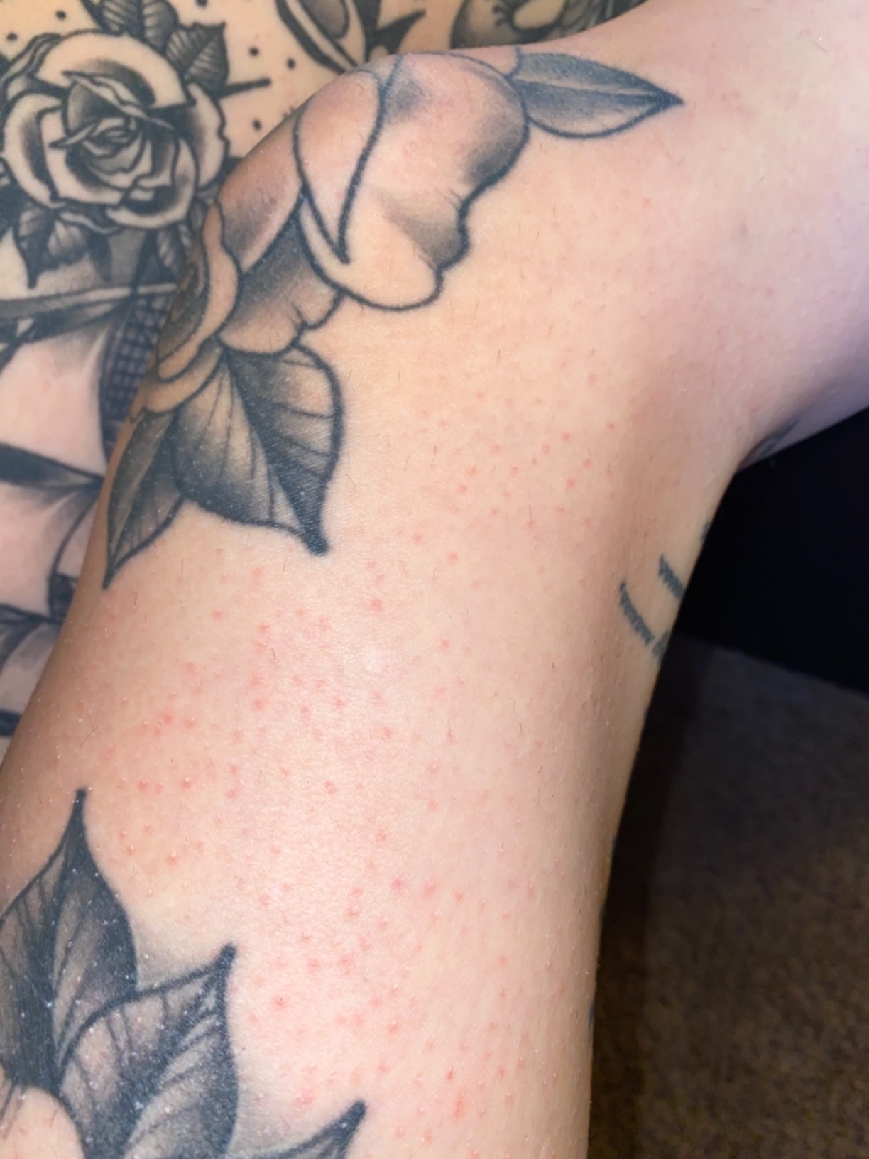 Braun Silk-épil 3 3-270, Epilator for Women for Long-Lasting Hair Removal, 20 Tweezer System, Smartlight Technology, Massage Rollers, Shaver and Trimmer Head Included customer photo 2