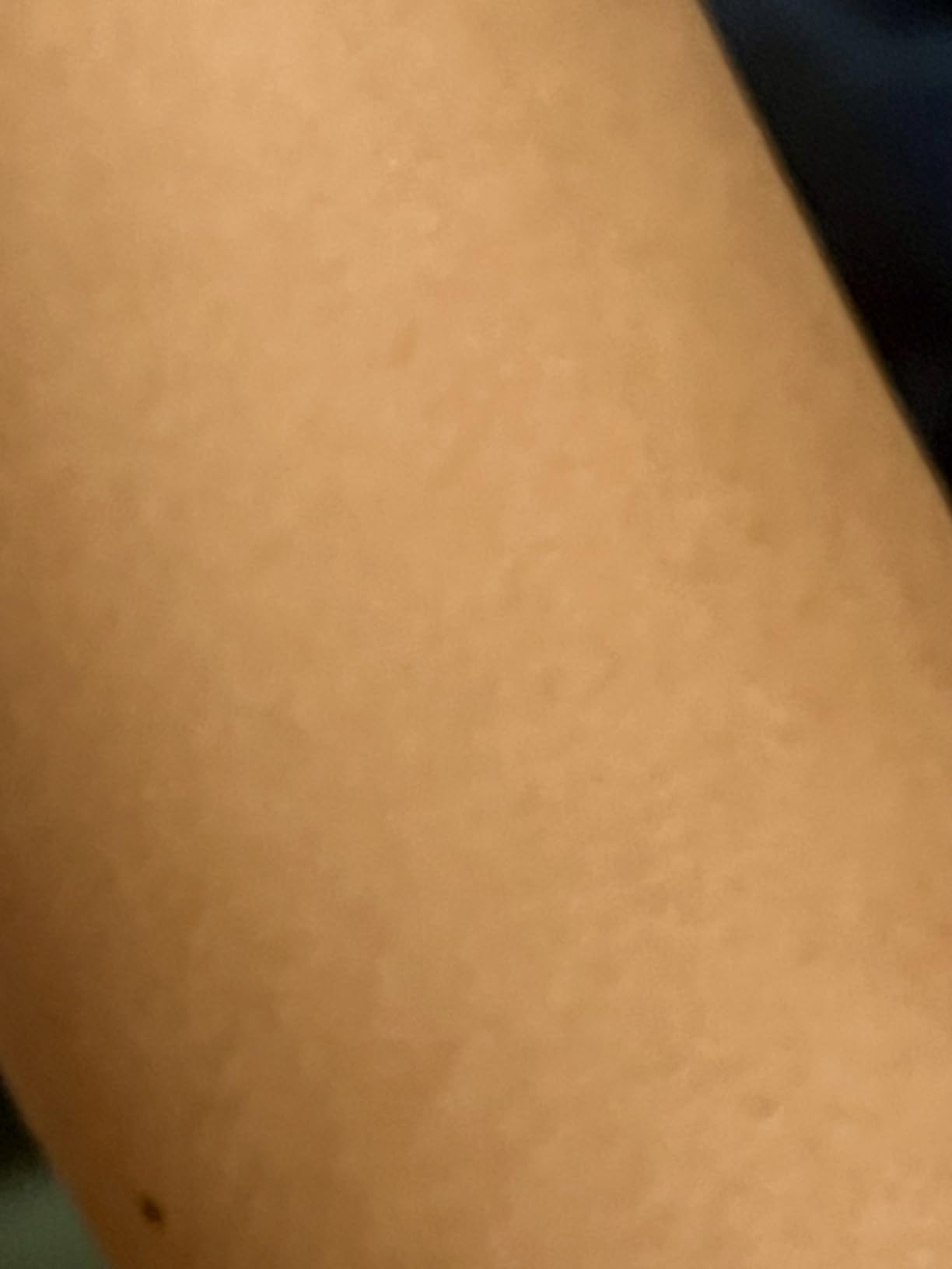 Braun Smart IPL, Skin i·Expert Pro 7, VOGUE's Best Hair Removal Device, IPL Hair Removal for Women and Men, Permanent Laser Hair Reduction At-Home, World's 1st Smart App, 4 Heads, IPL7387 customer photo 1