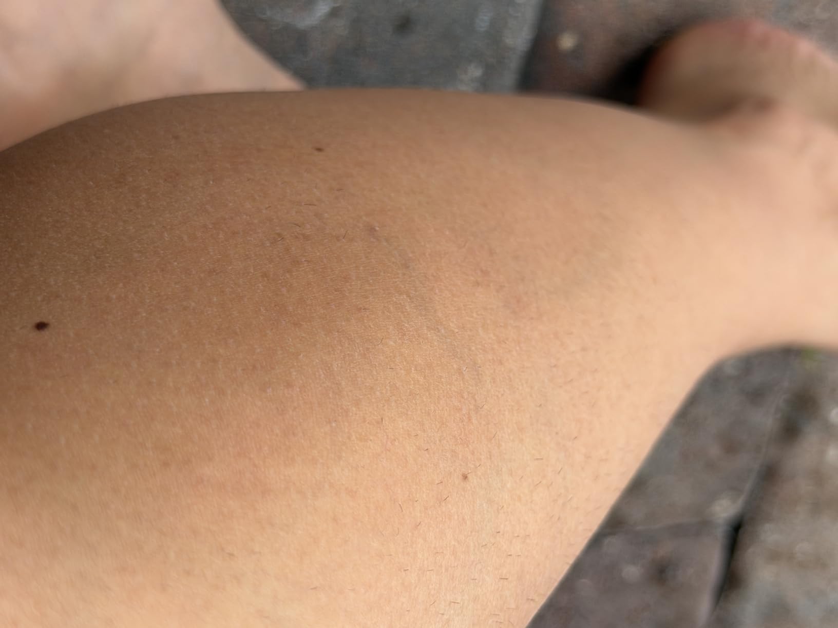 Braun Smart IPL, Skin i·Expert Pro 7, VOGUE's Best Hair Removal Device, IPL Hair Removal for Women and Men, Permanent Laser Hair Reduction At-Home, World's 1st Smart App, 4 Heads, IPL7387 customer photo 2