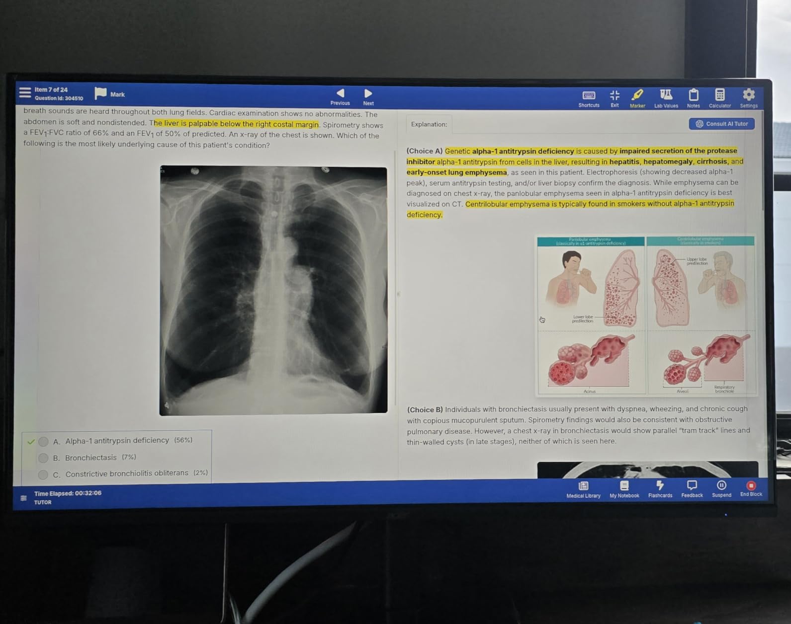Acer 27in FHD 1920x1080 IPS 120Hz Office Monitor KB272 G0bi | 1ms, AdaptiveSync (FreeSync Compatible), sRGB 99%, HDMI, VGA, VESA Mountable, Bluelight Filter, Flickerless Technology customer photo 1