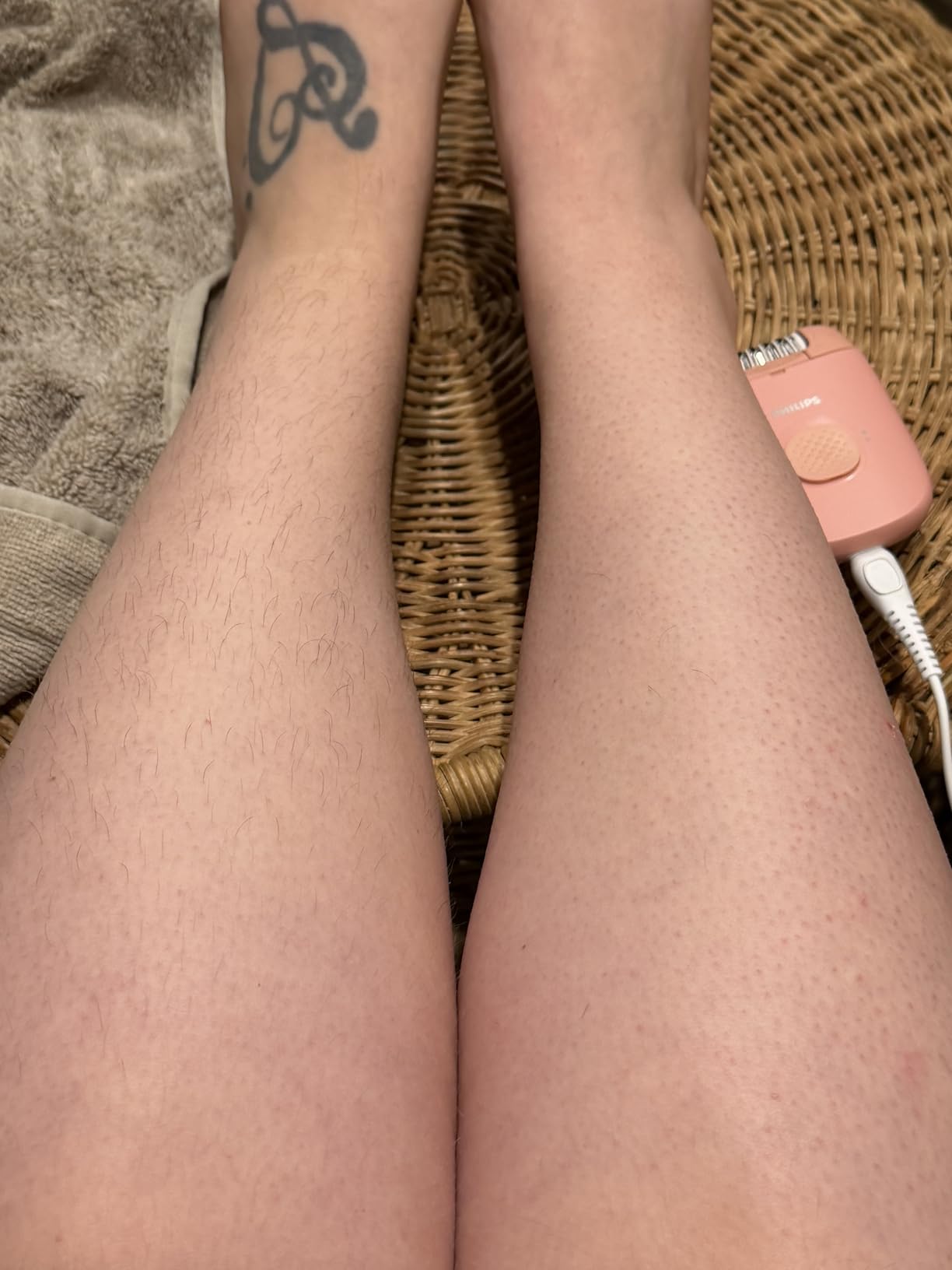 Philips Epilator Series 2000, Corded Epilator for Legs and Body, Hair Removal Device for Women, Model BRE227/00 customer photo 2