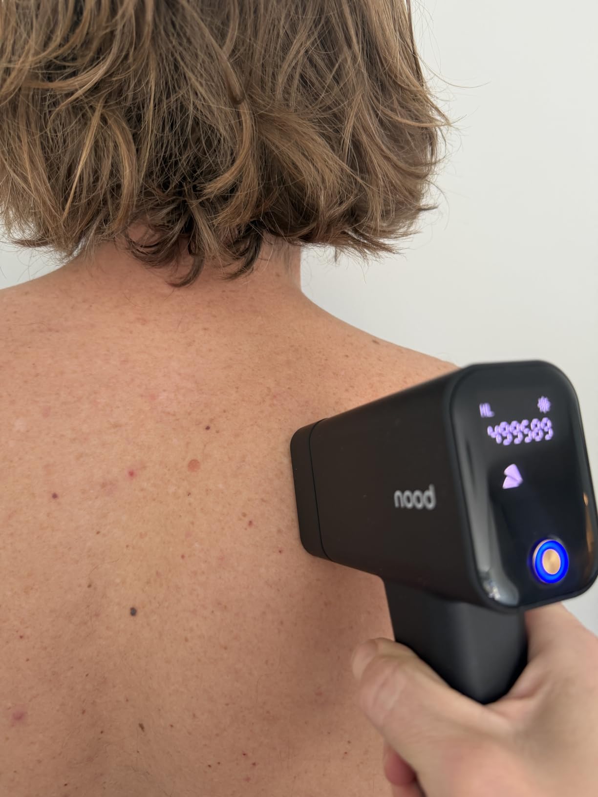 Nood™ Flasher Pro | IPL Laser Hair Removal Device, Forbes Best Product 2026 customer photo 1